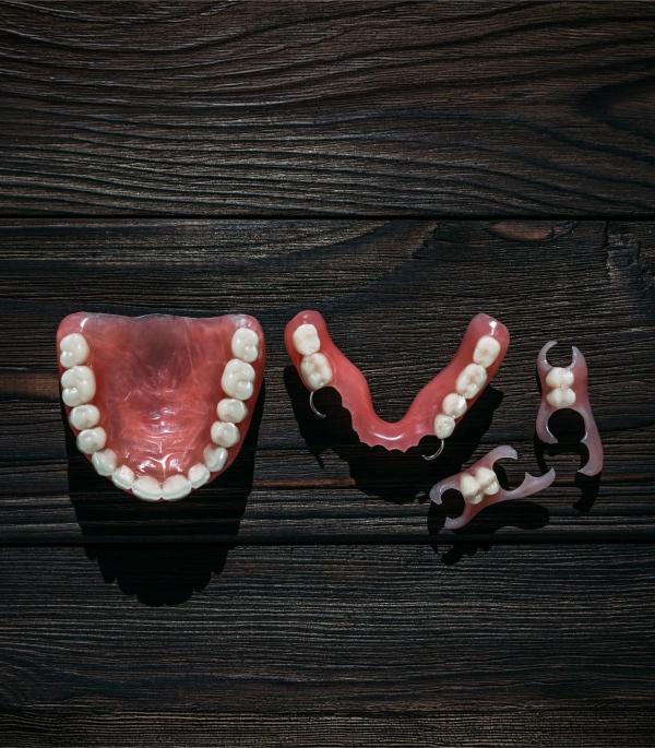Partial dentures displayed on a dental model